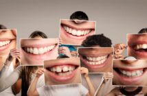 Wie viele Zähne hat ein Mensch: Milchgebiss, bleibende Zähne und was passiert, wenn die Zähne fehlen (Foto: AdobeStock - 377376885 xavier gallego morel)